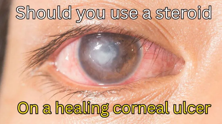 Should you use a steroid(1)