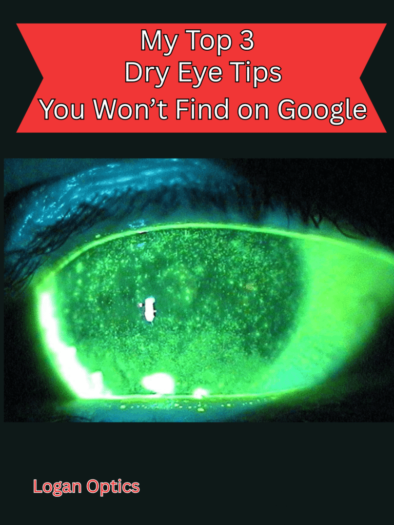 Free dry eye e-book
